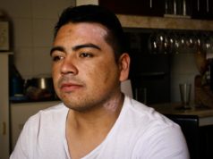 Gonzalo LLancao: “Nos queman con soda cáustica. Nos quieren asesinar”